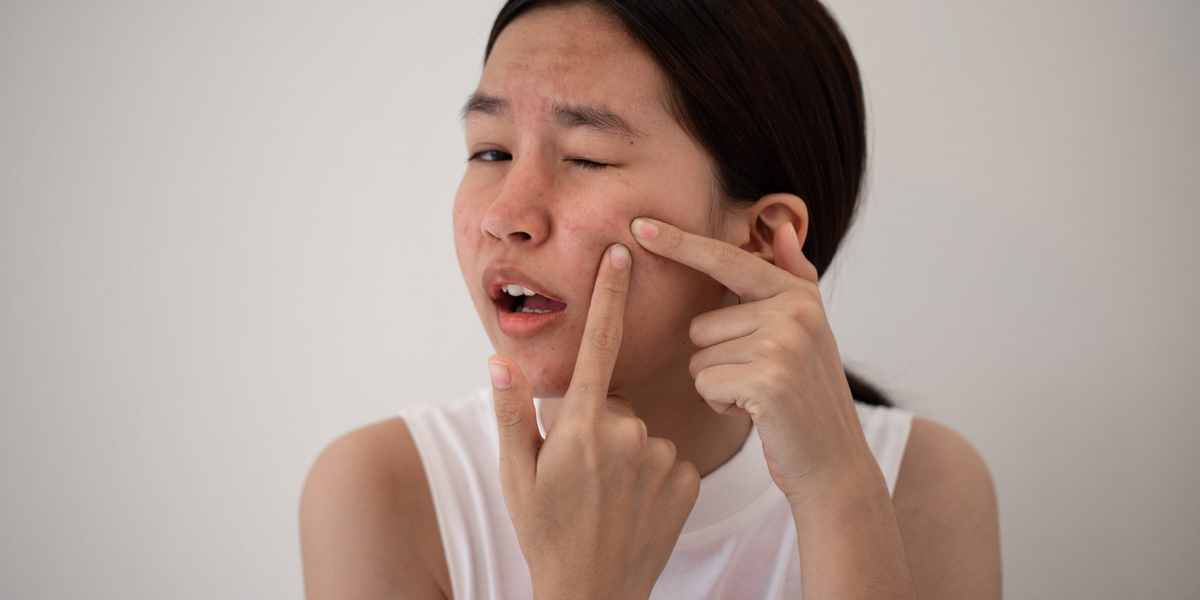 How Stress Is Secretly Sabotaging Your Skin (And What You Can Do About It)