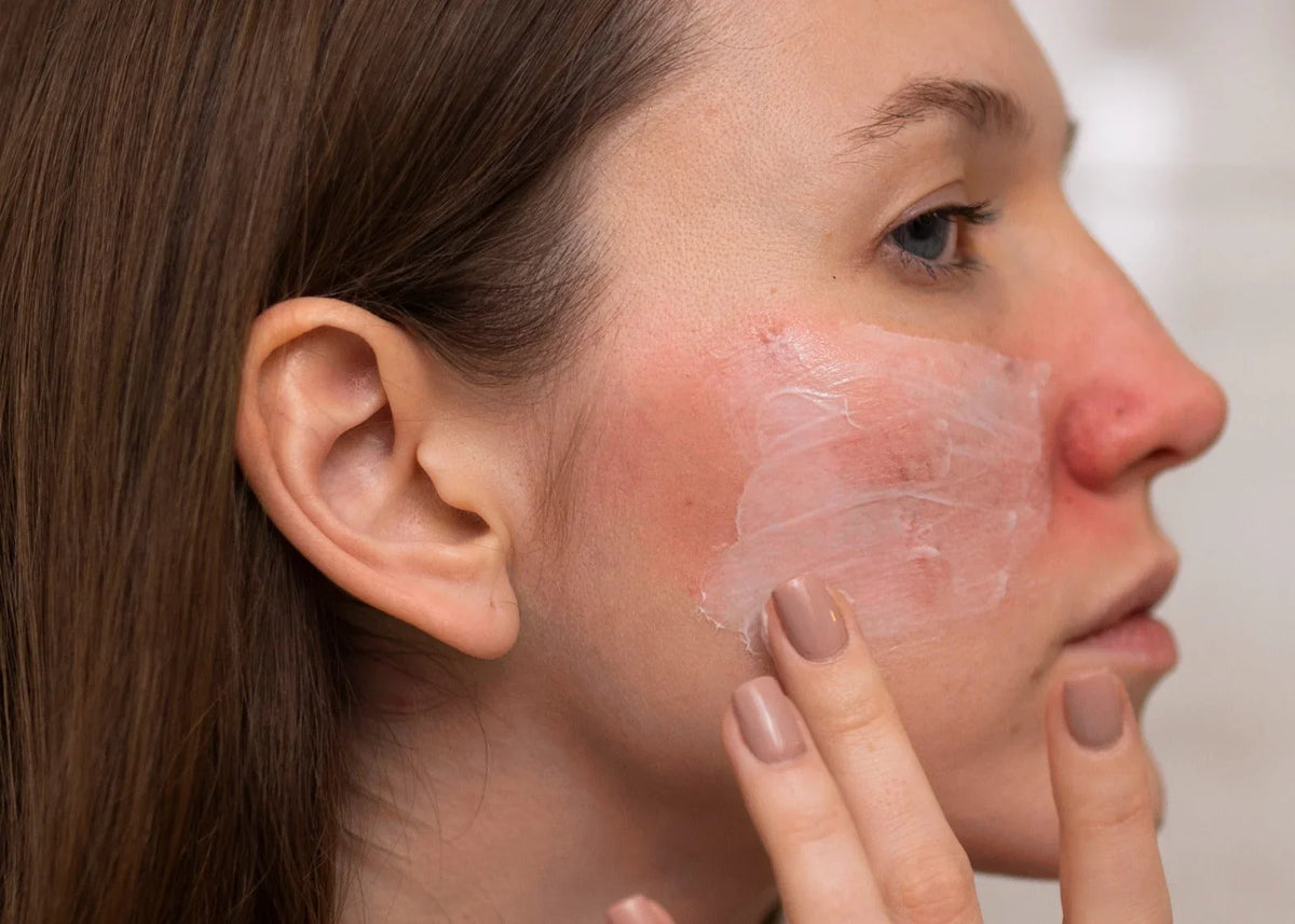 The Hidden Signs Your Skin Barrier Needs More Support
